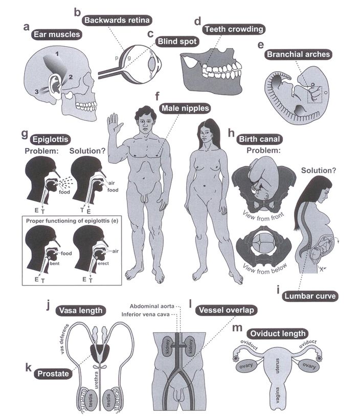 All the parts of human anatomy that don't have clear evolutionary advantages or seem actively unhelpful and poorly designed